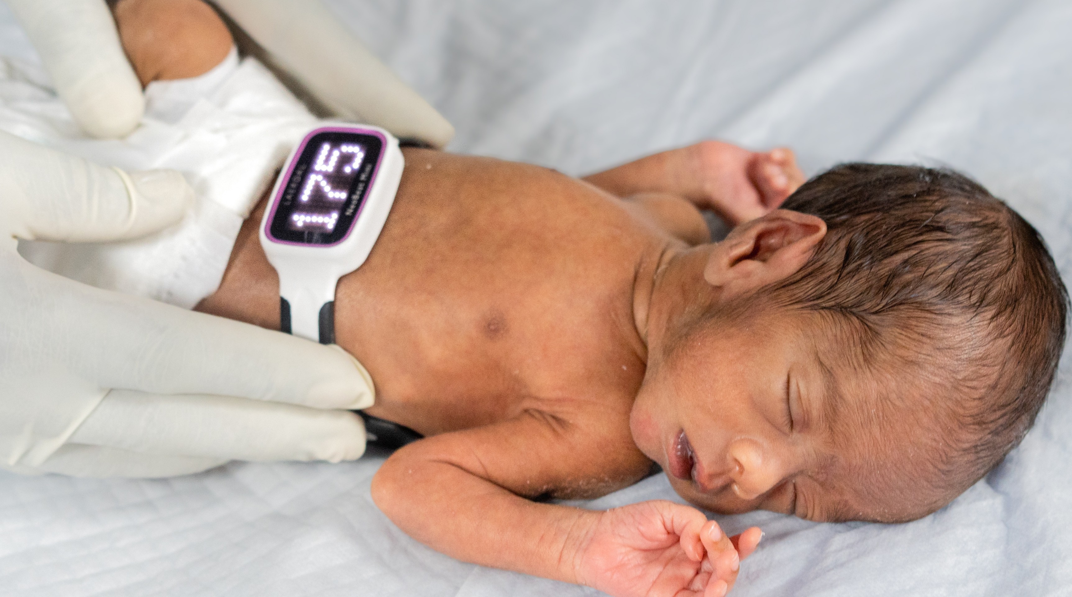 A baby wears a Laerdal Global Health Neo Beat heart rate monitor