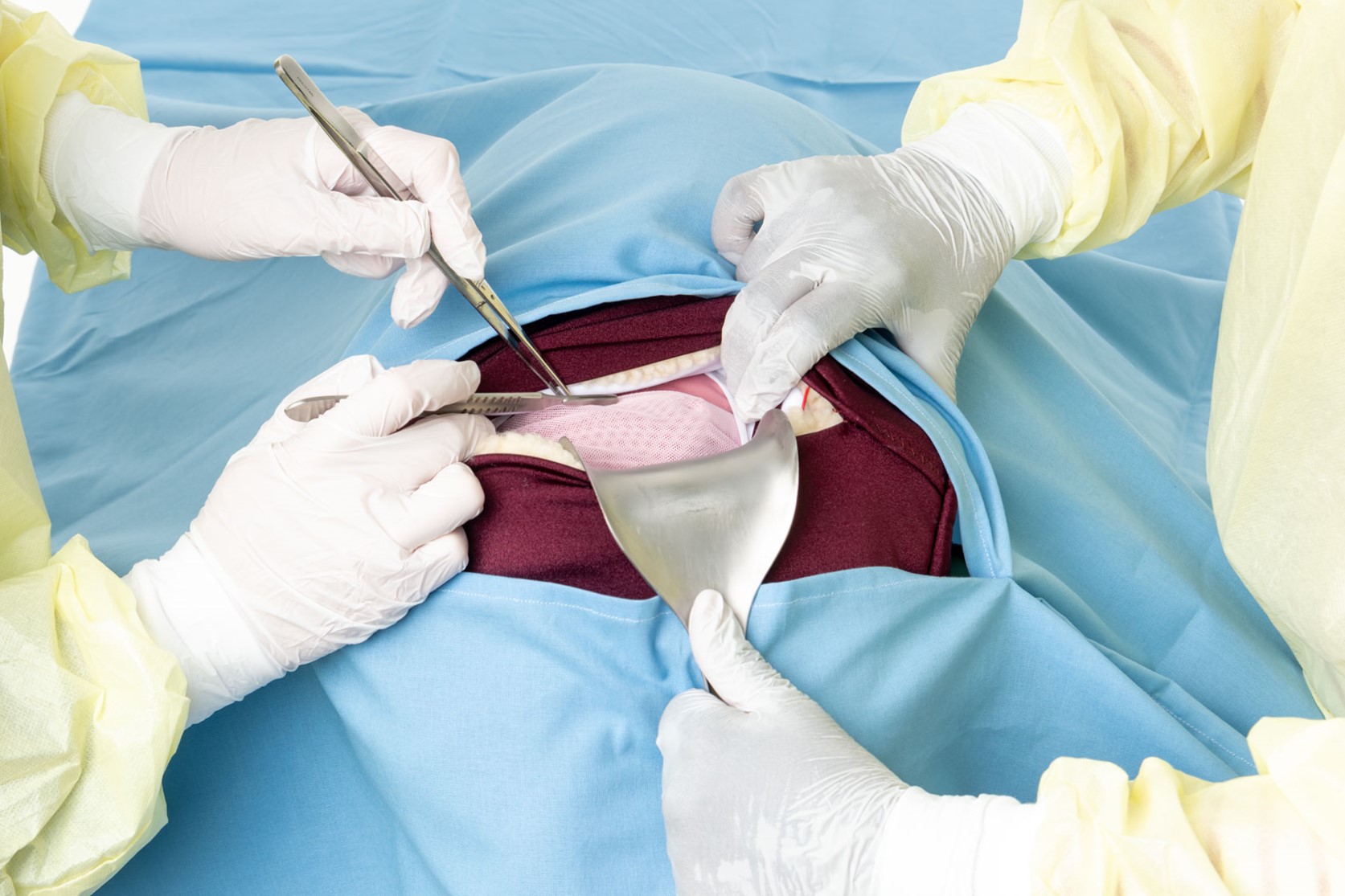 Healthcare providers practicing a cesarean section procedure on a MamaBirthie CS simulator during a hands-on training session.
